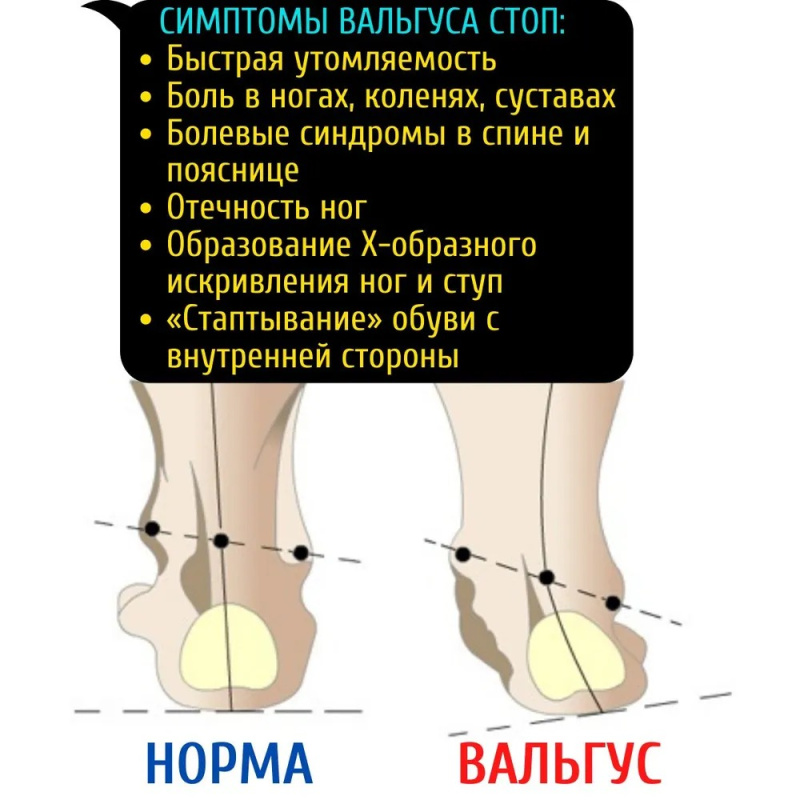 Ортопедические стельки ,размер  31-32  Ортопедические стельки ,размер  31-32