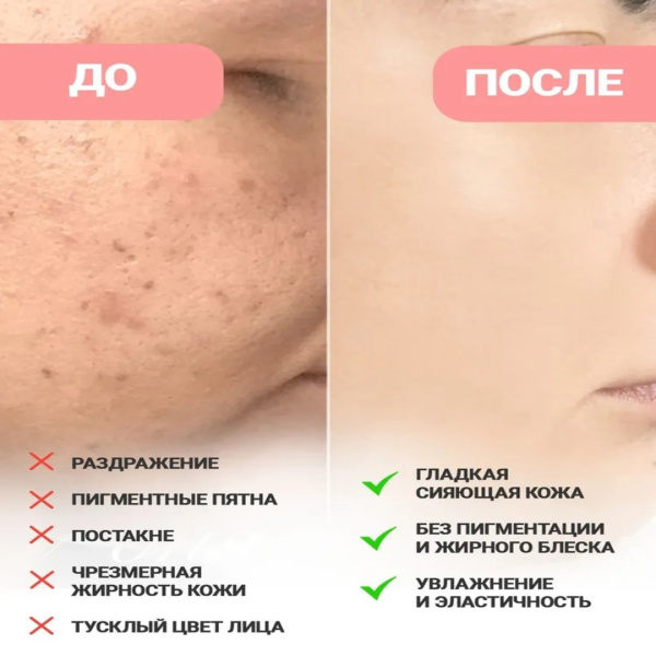 Anua Осветляющая сыворотка для лица с ниацинамидом и транексамовой кислотой 30 мл / Anua Niacinamide 10% + TXA 4% Serum 30 ml